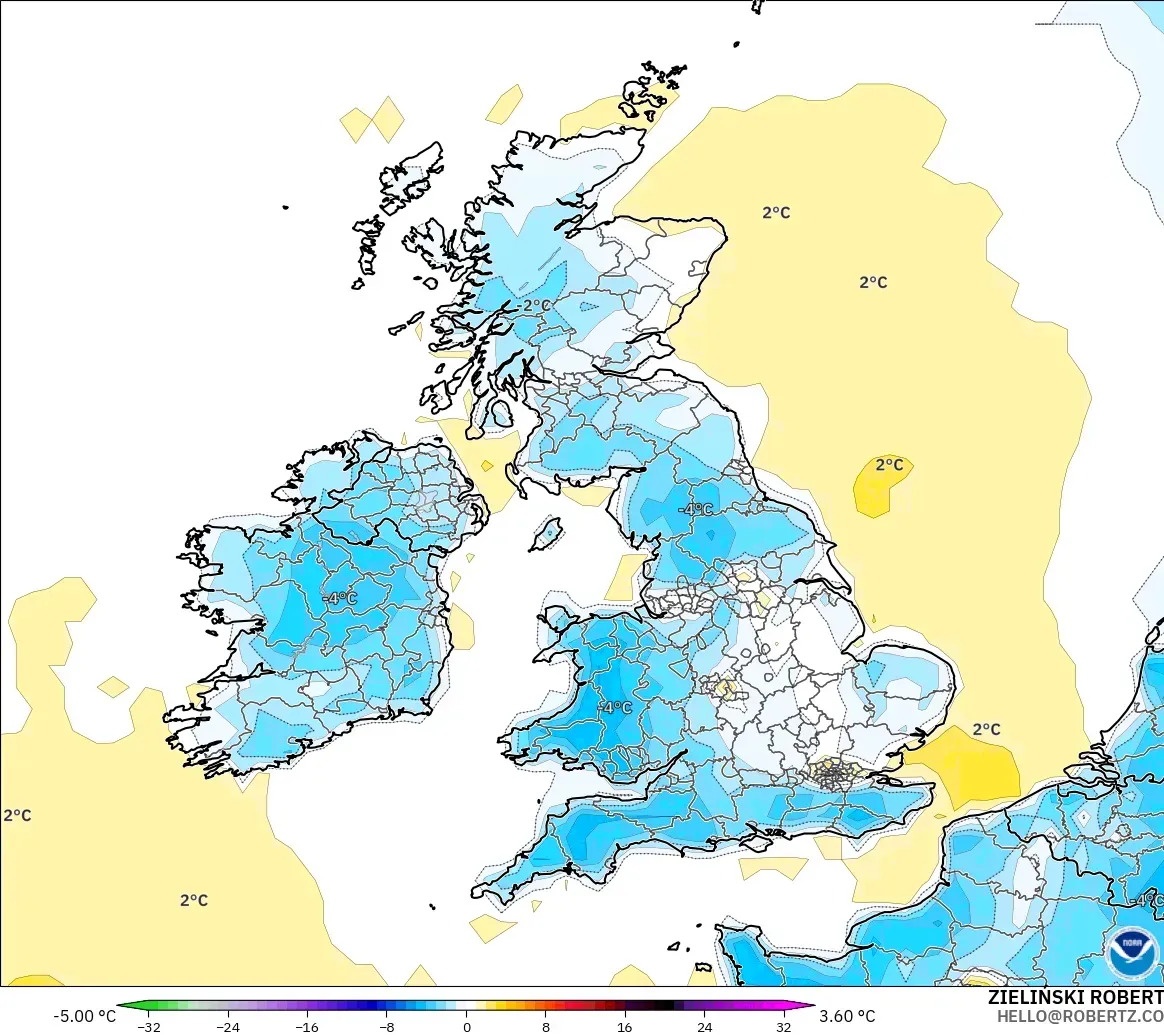GFS model - United Kingdom, Anomali Suhu 2 m